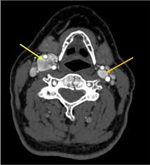 Image result for Sharp CBT-55