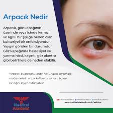 Arpacik Nedir Nasil Gecer Gozler Yastik Kilifi