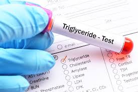 Image result for Triglyceride