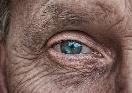 Glaucoma is a group of eye diseases that is caused by damage to the optic nerve related to high intraocular eye pressure (iop). Ocular S Sustained Release Insert Misses Bull S Eye In Phase 3 Glaucoma Trial Fiercebiotech