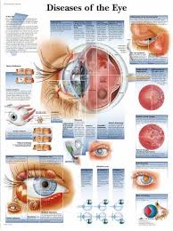Diseases Of The Eye Chart Vr1231