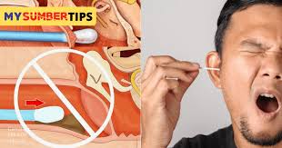 Jika dibiarkan sakit telinga bisa mengganggu aktivitas keseharian. Bahaya Kalau Gunakan Cotton Bud Korek Telinga Jadi Gunakan 4 Cara Ni