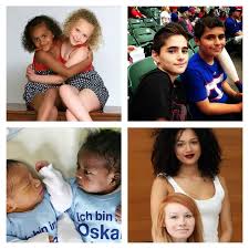 14 Biracial Twins Who Don T Look Like They Re Even Related Woman S World Biracial Twins Biracial Babies Biracial