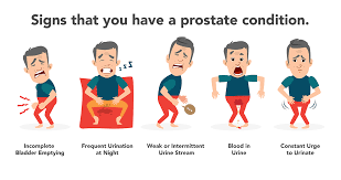 The pancreas is located behind the stomach, so having pancreatic cancer doesn't involve a palpable mass that you can feel. Prostate Cancer