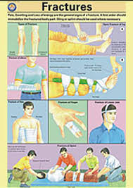 Spectrum Impex First Aid Charts