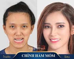 ĐÔI NÉT】Đội ngũ y bác sĩ chuyên khoa thẩm mỹ hàm mặt tại BVTM Kangnam
