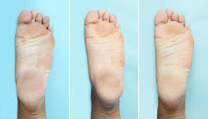 Keep your feet clean and dry to help prevent fungus. Baby Foot Peel Reviews Dupes And What To Know Before You Try It Self