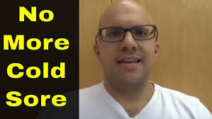 Cold Sore Laser Treatment by Flagstaff Dentist John L. Bacon, D.D.S.