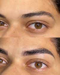 Clínica Estética Carolyne O. (@carolyneestetica_clinica) • Instagram photos  and videos