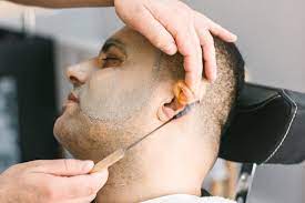 It is a safe and effective treatment with minimal discomfort, downtime and aftercare. Ear Hair Removal Most Effective Methods Techniques Beardoholic