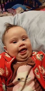 Unusual tongue appearance sparks disgust and speculation