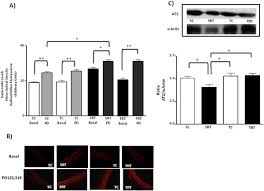 Moviesjoy is a free movies streaming site with zero ads. Influence Of Aerobic Training On The Reduced Vasoconstriction To Angiotensin Ii In Rats Exposed To Intrauterine Growth Restriction Possible Role Of Oxidative Stress And At2 Receptor Of Angiotensin Ii