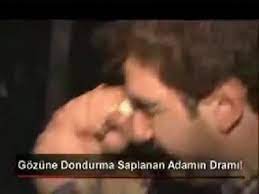 Gozune Dondurma Saplanan Adamin Drami Tekirdag Portali 59 Tekirdag In Haber Portali