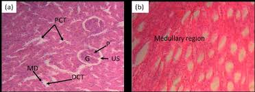 Image result for Erythrina sacleuxii