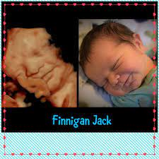 It is a fun time for the ultrasound as many times you will see movements like smiling, eyes blinking, hands moving, and many other movements. 3d Ultrasound Testimonials 3d 4d Ultrasound In Ft Myers Fl