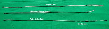 Basics Of Pacing Leads How To Pace