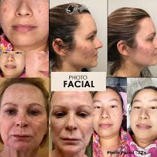 BeautyPros Permanent Cosmetic & Medspa