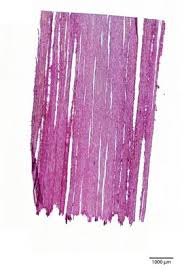 Image result for Dalbergia bracteolata