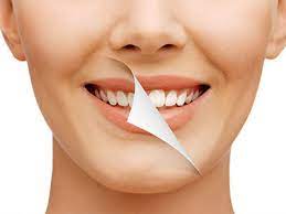 Check spelling or type a new query. Dental Bleaching In Ridgewood Ridgewood Teeth Whitening Teeth Bleaching Near Ridgewood