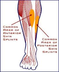 Tibialis posterior muscle is responsible for lifting and. Shin Splints Shin Splints Shin Splint Exercises Muscle Leg