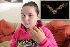 Image result for Bat Bite