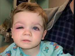 Eventually they can grow mold!!! Mom S Viral Warning On Tub Toys After Toddler S Terrifying Infection Gma