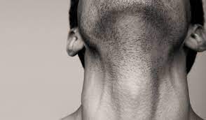 I'll be posting from time to time regarding my journey because i feel that i might not be first a good reference for you to get to know this disease is: Outcomes Are Favorable For Those Diagnosed With Thyroid Cancer
