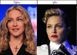 Find out which plastic surgery procedures are performed most often. Why And When Madonna At French Press Meet Had Her Plastic Surgery She Appears To Be Best After That Celeb Surgery Pictures Of Hollywood