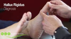 This device may impede gait, and if the extension is not fully. Hallux Rigidus Physiopedia