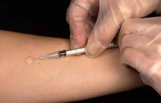 डॉट्स उपचार कैसे होता है, फायदे, साइड इफेक्ट - DOTS treatment kya hai, procedure, fayde, side effect in hindi