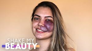 I Thought I'd Never Find Love With My Birthmark