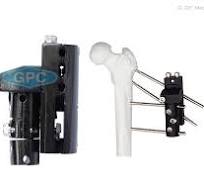 Pertrochanteric External Fixator