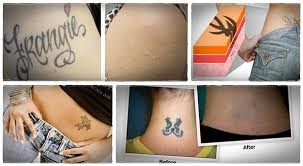 In fact, it's the only all natural method available today. Step By Step Natural Tattoo Removal How To Remove Tattoos At Home Naturally Natural Tattoo Removal Tattoo Removal Cost Tattoos