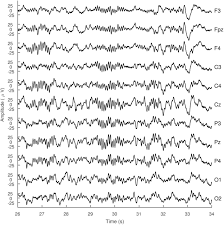 Multichannel Sleep Spindle Detection Using Sparse Low Rank Optimization Biorxiv
