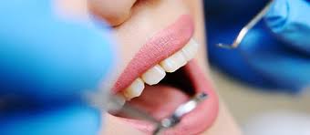Drug rehabilitation is the process of medical or psychotherapeutic treatment for dependency on psychoactive substances such as alcohol, prescription drugs, and street drugs such as cannabis, cocaine, heroin or amphetamines. Dental Implant Procedure Recovery Swiss Denture Center