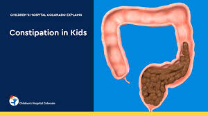 Image result for Pediatric Constipation