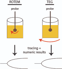 Image result for Thromboelastography