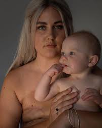 It didn't look like mastitis at all. They Survived Breast Cancer Now They Re Baring Their Scars And Their Souls Cnn Com