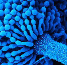 Maybe you would like to learn more about one of these? Pilzerkrankungen Infektion Mit Aspergillus Fumigatus Oft Todlich Welt