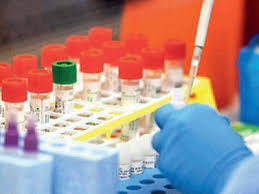 Kolkata Corona Update Flyers Arriving With Covid Symptoms Will Be Taken To Cnci For Swab Test Kolkata News Times Of India