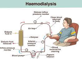 Kidney Failure Symptoms Causes And Treatment Healthdirect