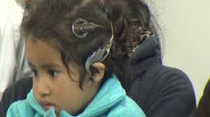 Niña recupera audición en el Estado de México