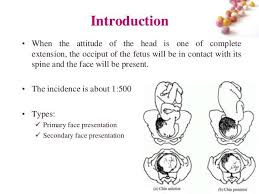 Image result for Face Presentation