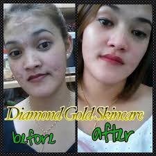 Produk ini tidak mengandungi mercury. Ruang Coretan Cik Ila Kidal Diamond Gold Skincare