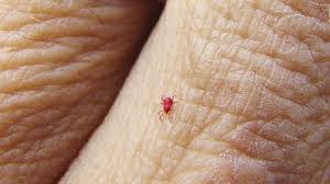 Image result for mite bites on humans