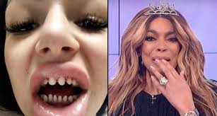 The video sees temporary veneers placed in price's mouth ). Tiktok Teens Warned Against Veneers And Shaving Their Teeth Popbuzz