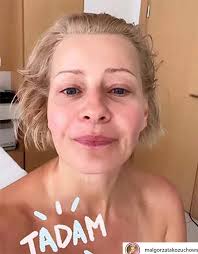Małgorzata kożuchowska w filmie czyściec o kobiecie, która doświadcza objawienia. Malgorzata Kozuchowska Pokazala Twarz Po Zabiegu Japonskim Liftingiem Pikio