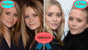 15 looks that make the olsen twins look old af. Mary Kate Olsen Plastic Surgery Why Do Mary Kate And Ashley Look So Old Top Piercings