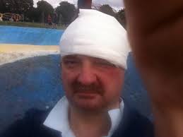 Dude from Pittsburgh got hit with a helmet to the head and kept playing ‼️