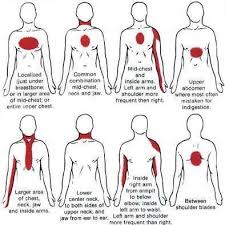 Security Check Required Signs Of Heart Attack Heart Attack Symptoms Medical Information